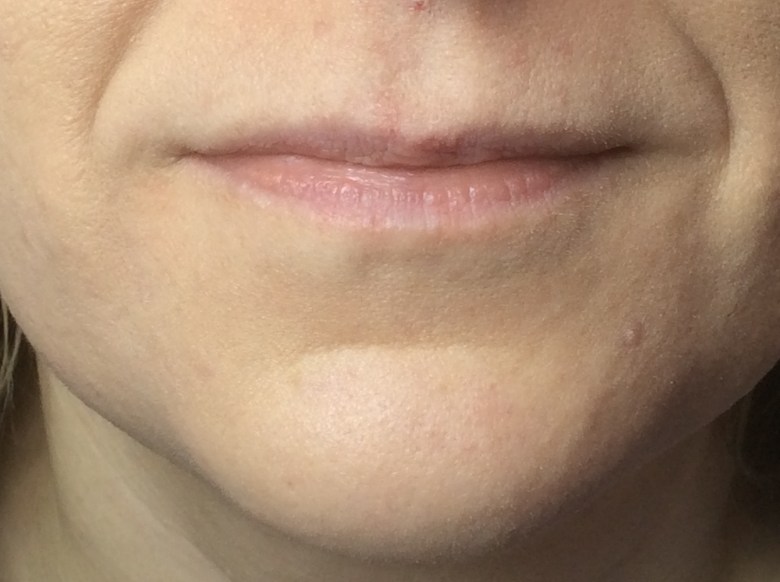 3F0C0F17-82D0-4510-8ED1-6BDE4B64890D