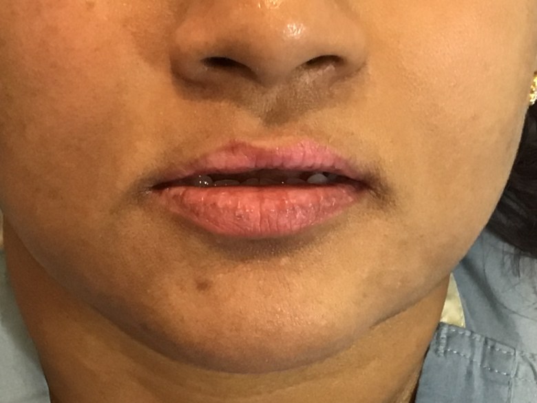 E4DCA98B-6B9D-4C56-AE94-869A8217940D